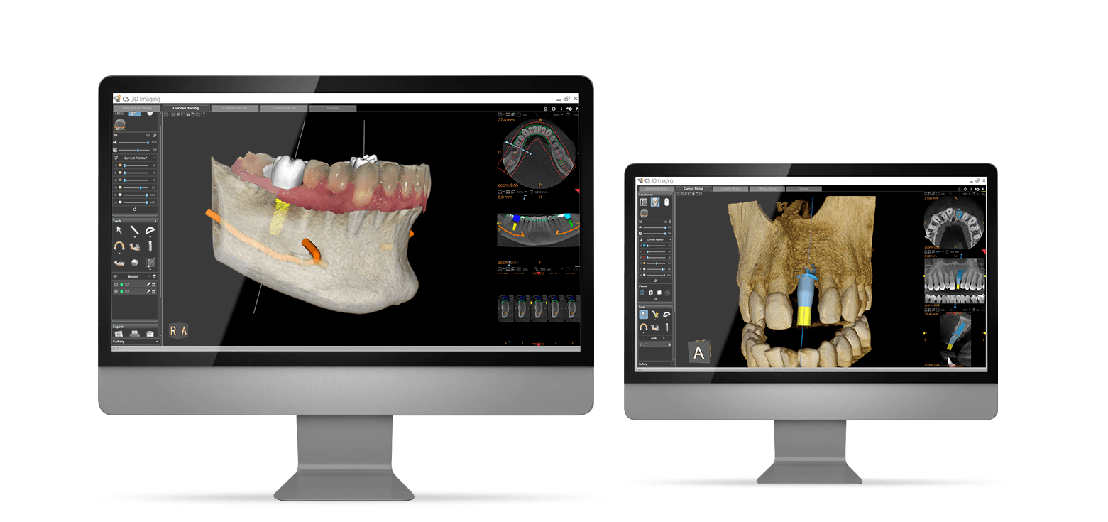 Dental Implants Centre 