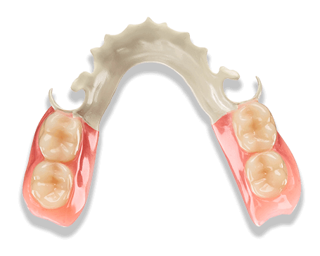 Lower Jaw partial dentures