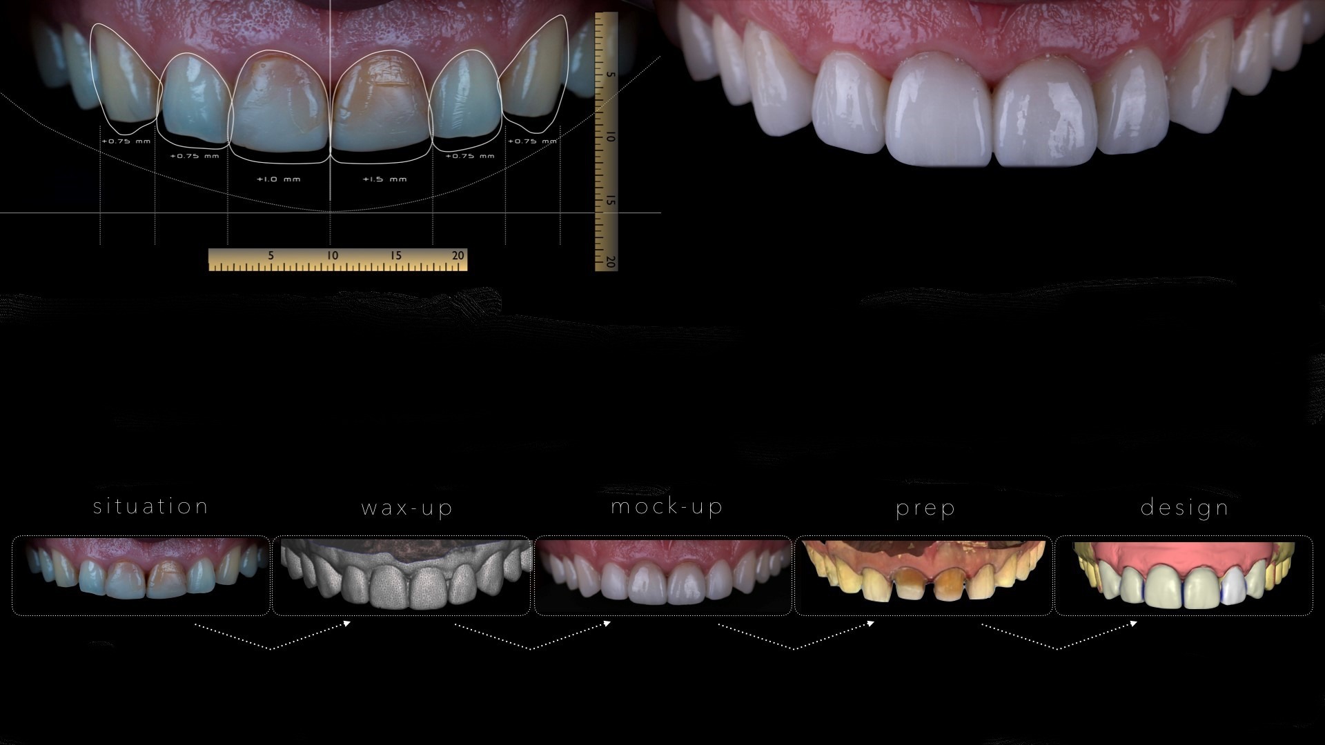 Top Cosmetic Dentistry Clinic