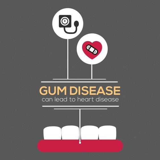 dental hygiene - gum disease
