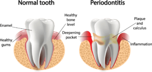 gum dentistry