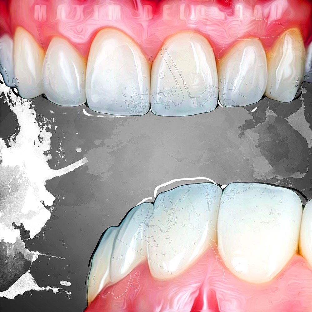 sensitive teeth treatment options