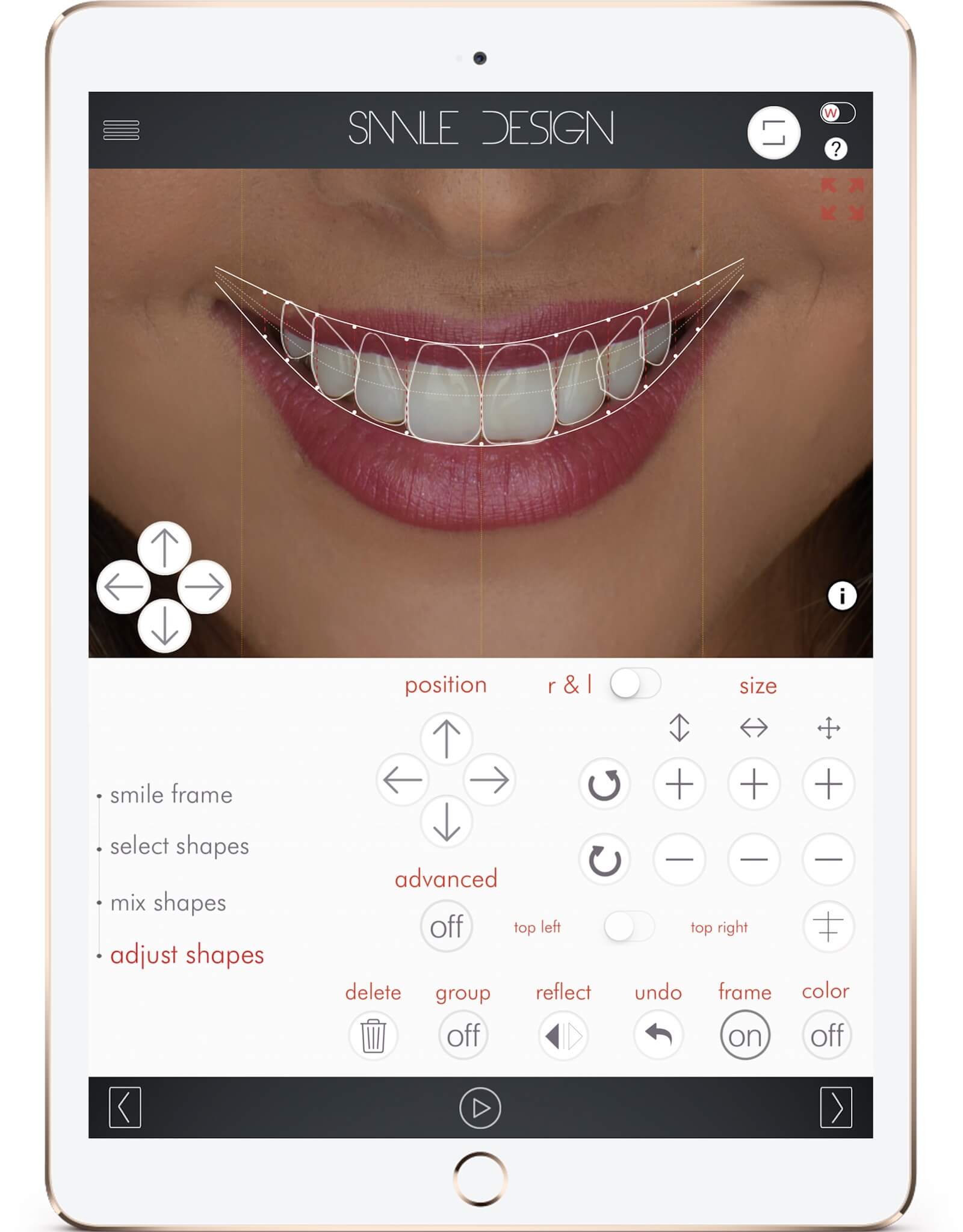 Smile Makeover Options 